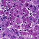 Image for article titled This Ebola-Type Fever is Named After a Town in Germany